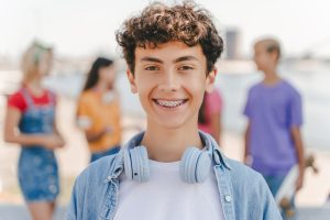 Dental Braces: Your Complete Guide to a Straighter Smile