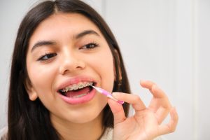 Essential Braces Care: Tips for Maintaining a Healthy Smile